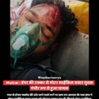 डंपर की टक्कर से मोटर साईकिल सवार युवक गंभीर रूप से हुआ घायल